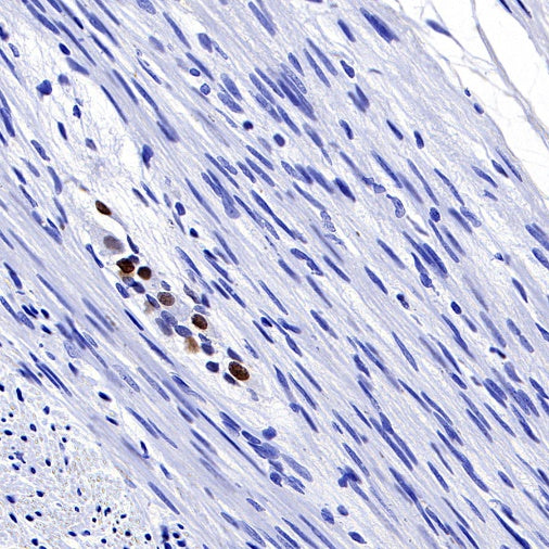 PHOX2B Recombinant Rabbit mAb (SDT-1142-21)