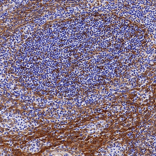 STING Recombinant Rabbit mAb (S-1392-33)