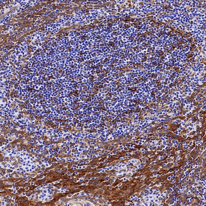 STING Recombinant Rabbit mAb (S-1392-33)