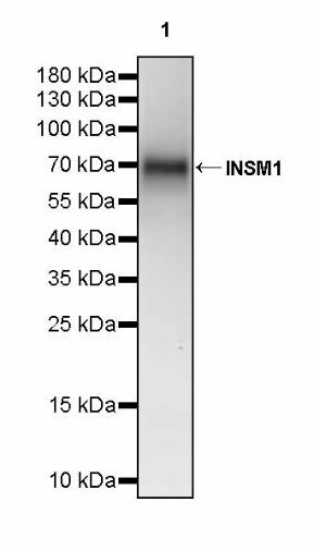 INSM1 Recombinant Rabbit mAb,PBS Only (SDT-3165-72)
