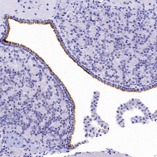 ARL13B Recombinant Rabbit mAb (S-2113-11)