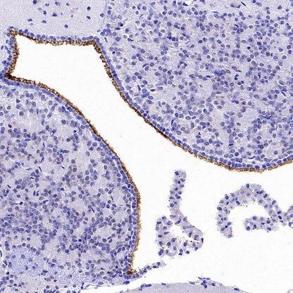 ARL13B Recombinant Rabbit mAb (S-2113-11)