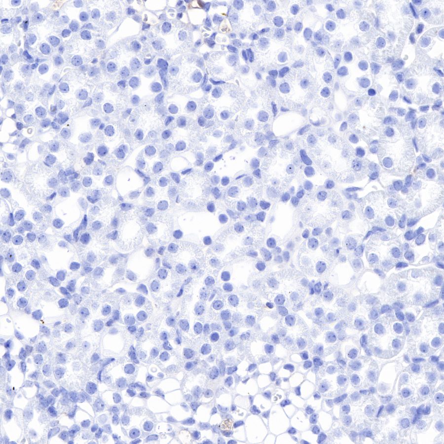 alpha-actinin-2 Recombinant Rabbit mAb (SDT-032-79)
