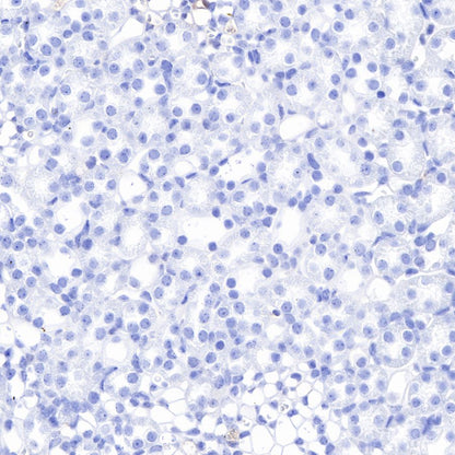 alpha-actinin-2 Recombinant Rabbit mAb (SDT-032-79)