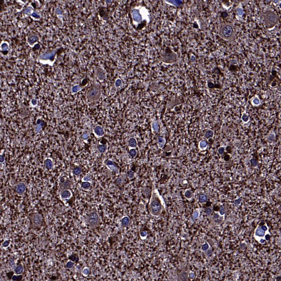 BIN1 Recombinant Rabbit mAb (S-4287-18)