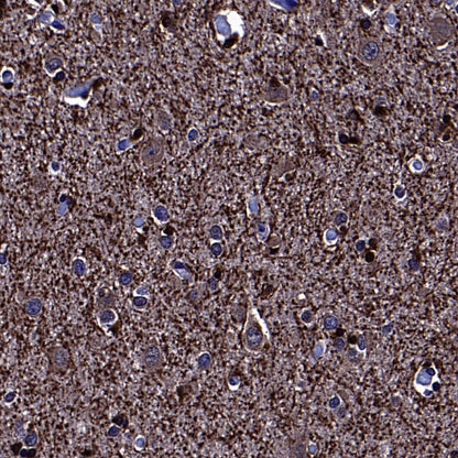 BIN1 Recombinant Rabbit mAb (S-4287-18)