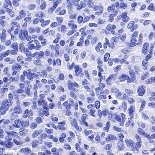 TMEM16A Recombinant Rabbit mAb (SDT-2179-12)