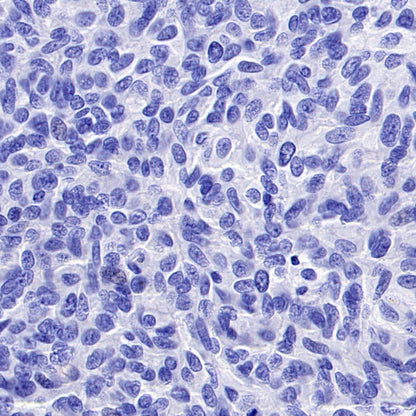 TMEM16A Recombinant Rabbit mAb (SDT-2179-12)