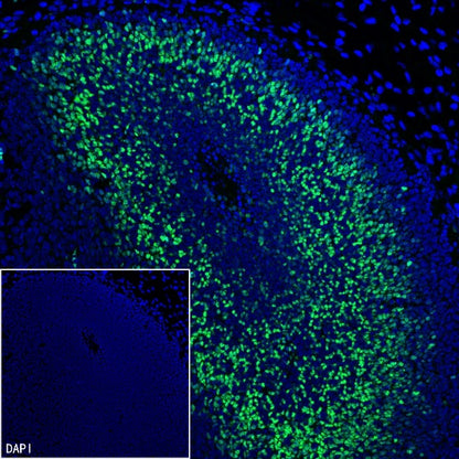 TBR2/Eomes Recombinant Rabbit mAb (SDT-1101-231)