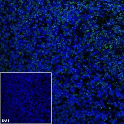 Mouse Anti-Human CD45RO Antibody (UCHL1)