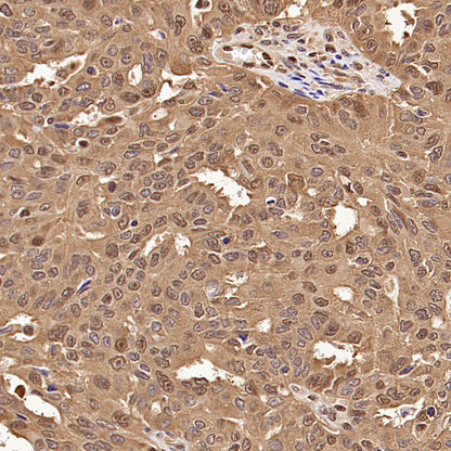 S-RMab® GAPDH Recombinant Rabbit mAb (S-240-147)