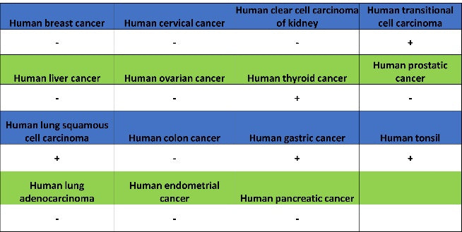 Collagen XVII Recombinant Rabbit mAb (S-1636-5)