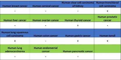 Collagen XVII Recombinant Rabbit mAb (S-1636-5)