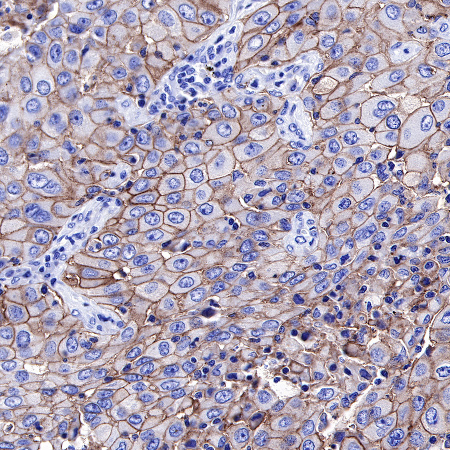 PD-L1 Recombinant Rabbit mAb,PBS Only (SDT-R017)