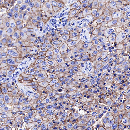 PD-L1 Recombinant Rabbit mAb,PBS Only (SDT-R017)