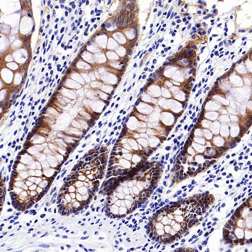 p90RSK Recombinant Rabbit mAb (S-1024-26)