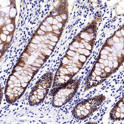 p90RSK Recombinant Rabbit mAb (S-1024-26)