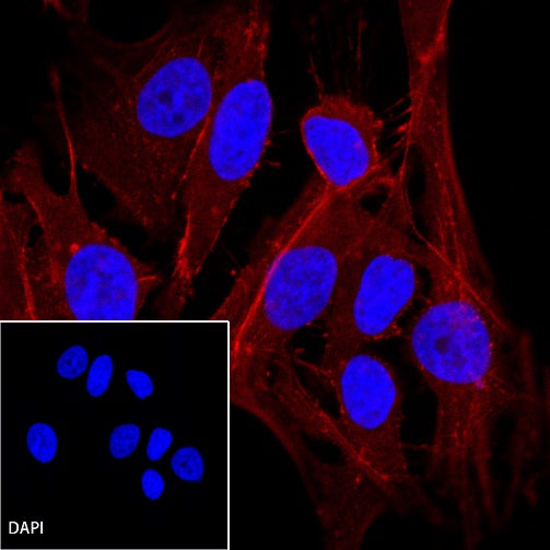 β-actin Recombinant Rabbit mAb (Alexa Fluor® 594 Conjugate) (S-R156)