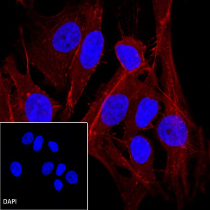 β-actin Recombinant Rabbit mAb (Alexa Fluor® 594 Conjugate) (S-R156)