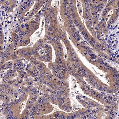 TSG101 Recombinant Rabbit mAb (S-1868-76)