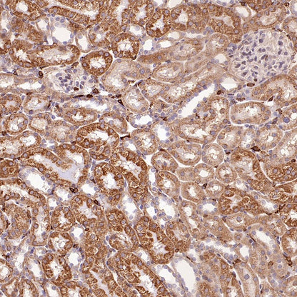 SFXN1/TCC Rabbit Polyclonal Antibody