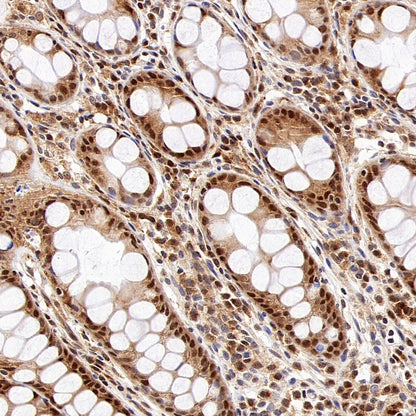 PGC1 beta Recombinant Rabbit mAb (S-1212-146)
