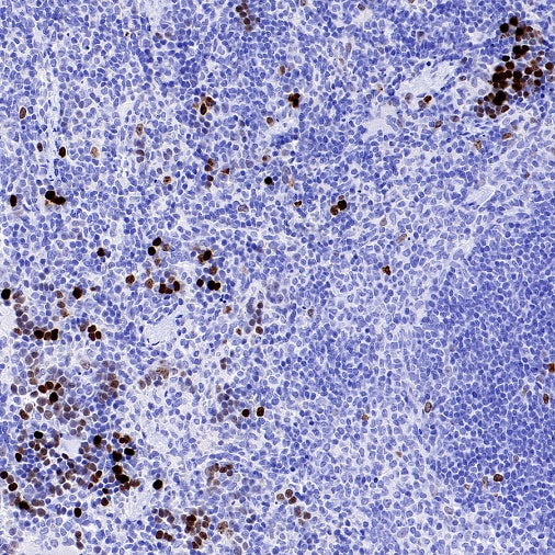 JNK1 + JNK2 + JNK3 (phospho T183+T183+T221) Recombinant Rabbit mAb (S-3593)