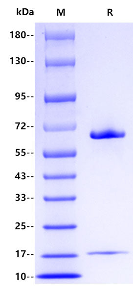 PCSK9 His Tag Protein, Human