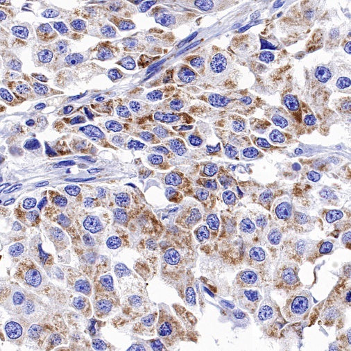 NDUFA1 Recombinant Rabbit mAb (S-1277-177)