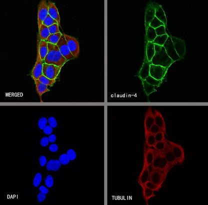 Claudin 4 Recombinant Rabbit mAb (SDT-814-53)