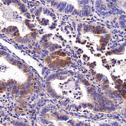 S-RMab® Bcl-2 Recombinant Rabbit mAb,PBS Only (SDT-R160)