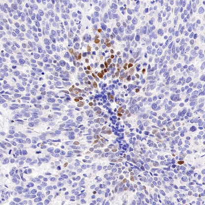 c-Fos Recombinant Rabbit mAb (S-1391-63)