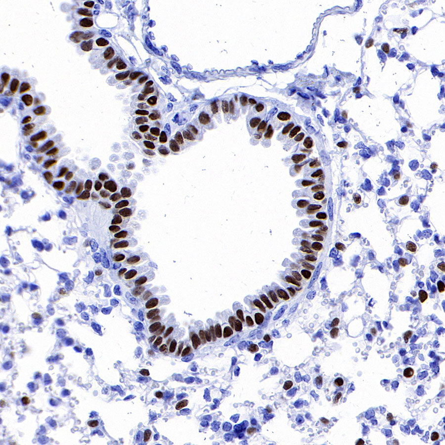 FOXA2 Recombinant Rabbit mAb (SDT-R174)