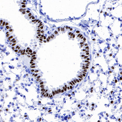 FOXA2 Recombinant Rabbit mAb (SDT-R174)