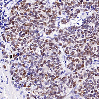 Islet1 Recombinant Rabbit mAb (SDT-2349-17)