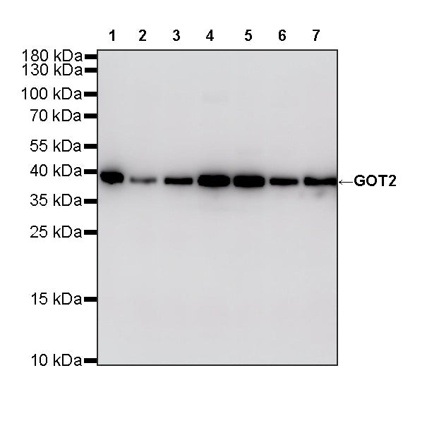 GOT2 Recombinant Rabbit mAb