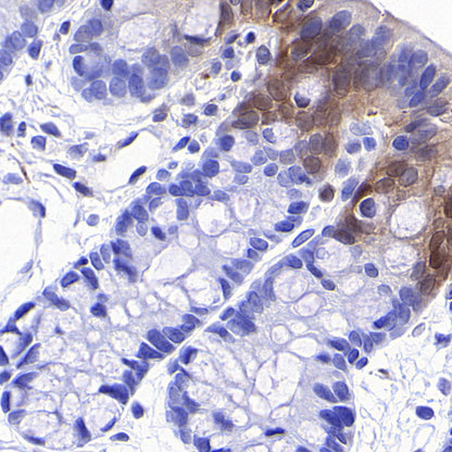 Phospho-p44/42 MAPK (Erk1/2) (Thr202/Tyr204) Recombinant Rabbit mAb (S-5119)