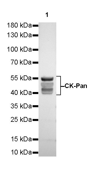S-RMab® CK-Pan Recombinant Rabbit mAb,PBS Only (SDT-P001)