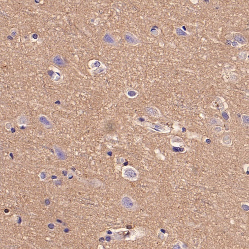 Rac1/2/3 Recombinant Rabbit mAb (S-2720-10)