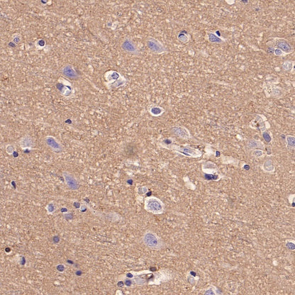 Rac1/2/3 Recombinant Rabbit mAb (S-2720-10)