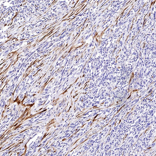 Calretinin Recombinant Rabbit mAb (SDT-2773-21)