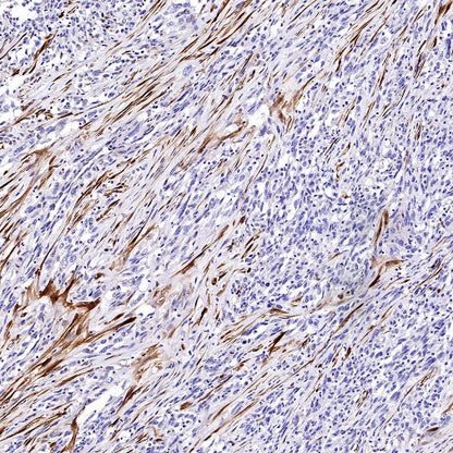 Calretinin Recombinant Rabbit mAb (SDT-2773-21)