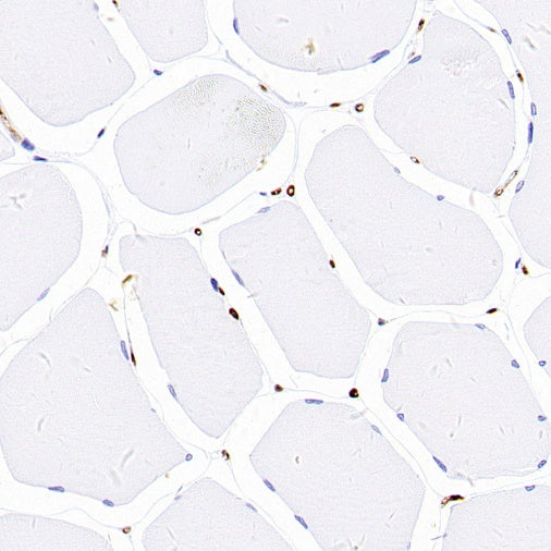 FABP4 Recombinant Rabbit mAb (S-1360-168)