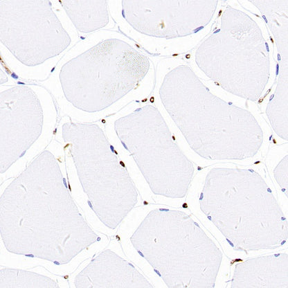 FABP4 Recombinant Rabbit mAb (S-1360-168)