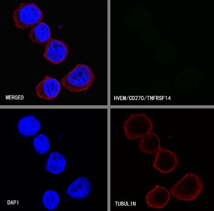HVEM/TNFRSF14 Recombinant Rabbit mAb (S-727-70)