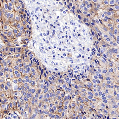 S-RMab® Nectin-4 Recombinant Rabbit mAb (SDT-277-314)