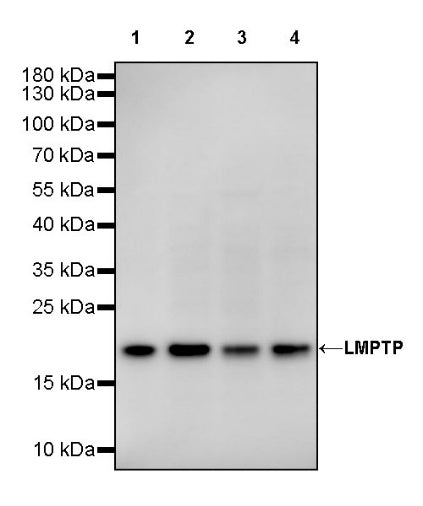 LMPTP Rabbit Polyclonal Antibody