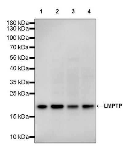 LMPTP Rabbit Polyclonal Antibody