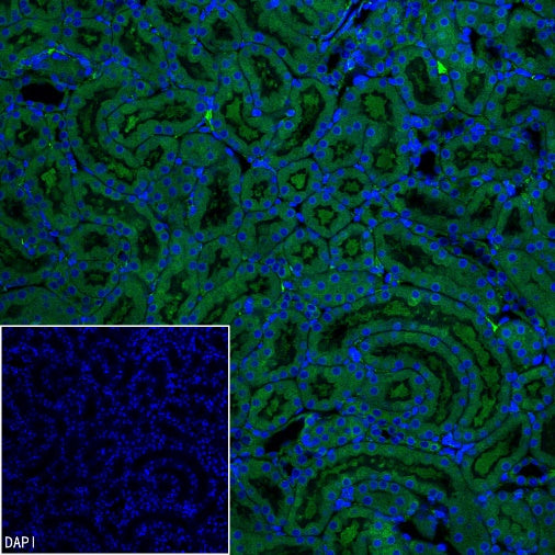 IRP2 Recombinant Rabbit mAb (S-4592-56)