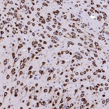 YTHDF2 Recombinant Rabbit mAb (S-1569-42)